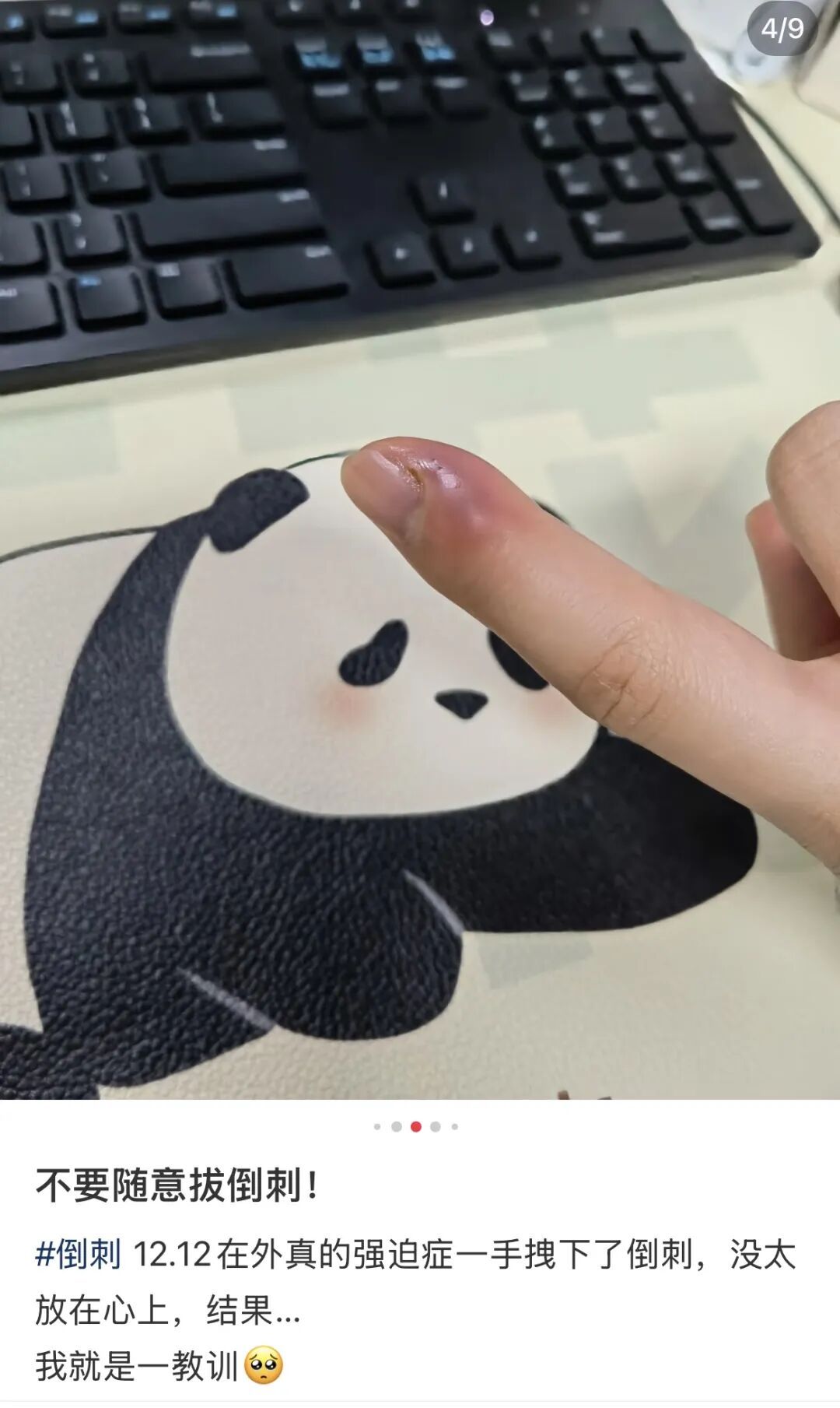 不要拔！不要拔！呼和浩特5岁男童顺手一拔，竟被送去医院！很多呼市人看见都忍不住！