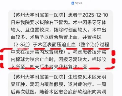 苏州一医院通报“男子拔牙发现伤口缝入棉条”：已对涉事医生给予停诊处理