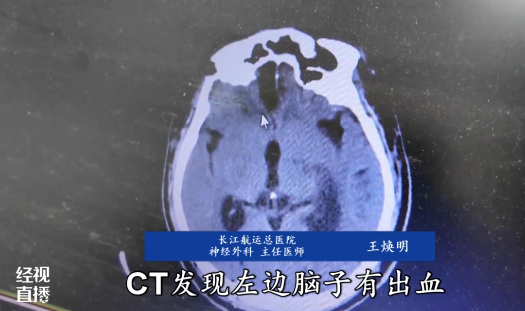 熬夜刷手机，武汉一男子脑血管意外“崩了”！医生提醒