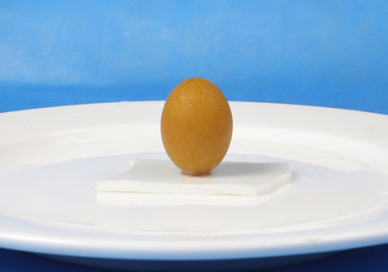 蜜蜡状胆囊结石现身贵阳，专家呼吁有这些习惯要警惕