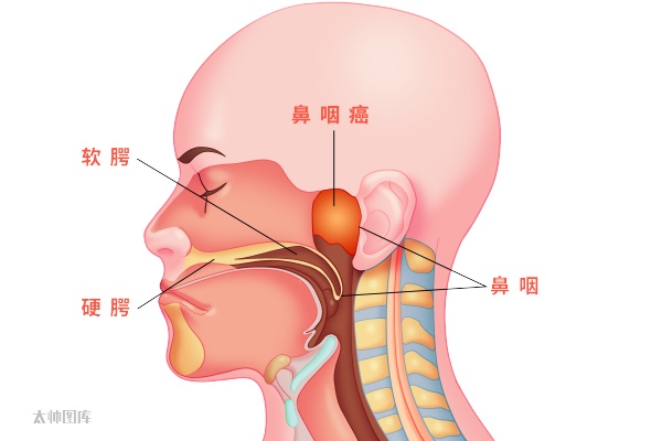 杭州大伯洗脸摸到腮帮有个硬疙瘩，竟是癌转移