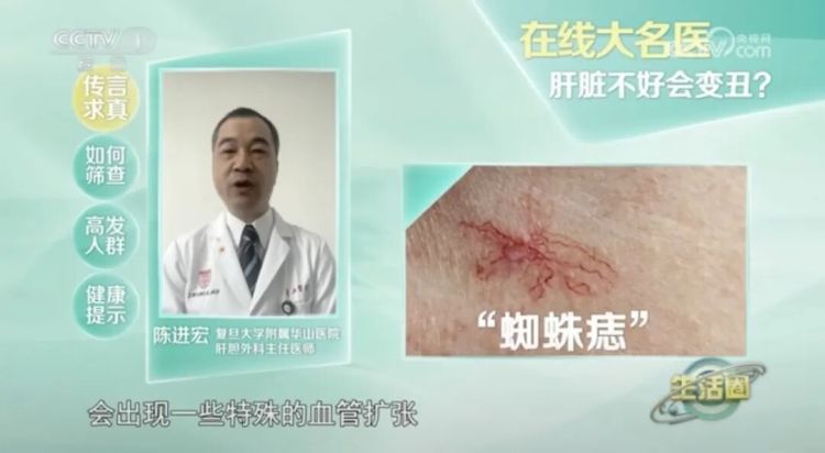 出现这种面相，可能是肿瘤前兆！别以为只是“发福”了