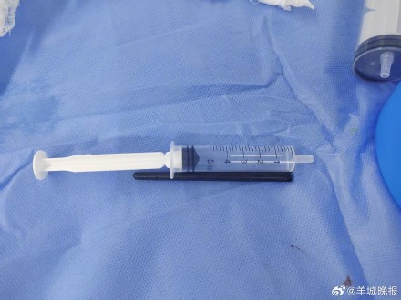 惊险！东莞一男子遭筷子贯穿颅底