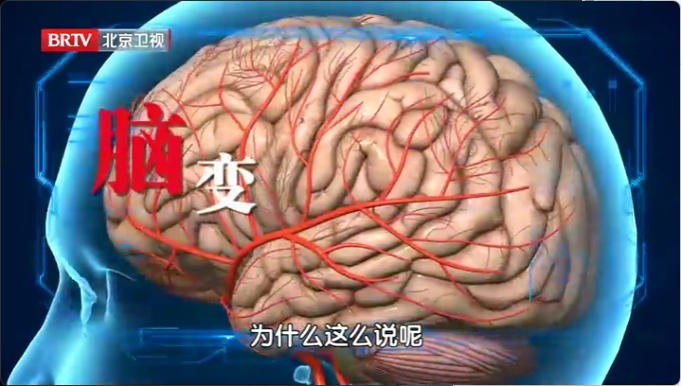 手指出现3个异常，说明脑梗离你很近，别错过抢救时间