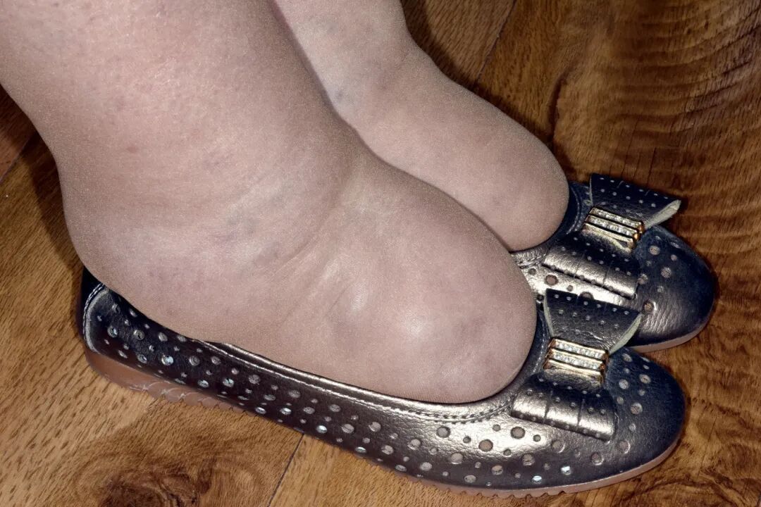 这种面相可能是恶疾前兆！24岁清秀女子样貌突变，"不爱喝奶茶也没遗传史"