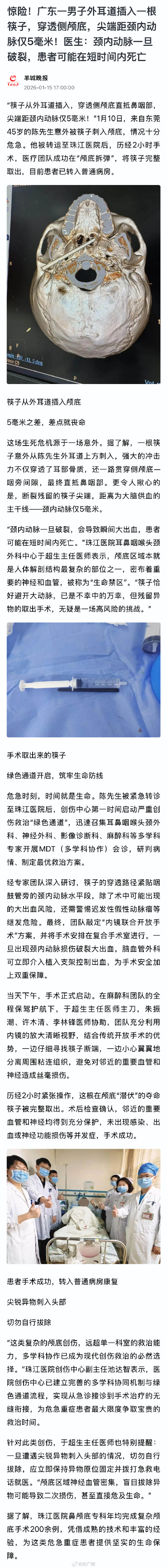 筷子刺入男子颅底 离动脉仅5毫米