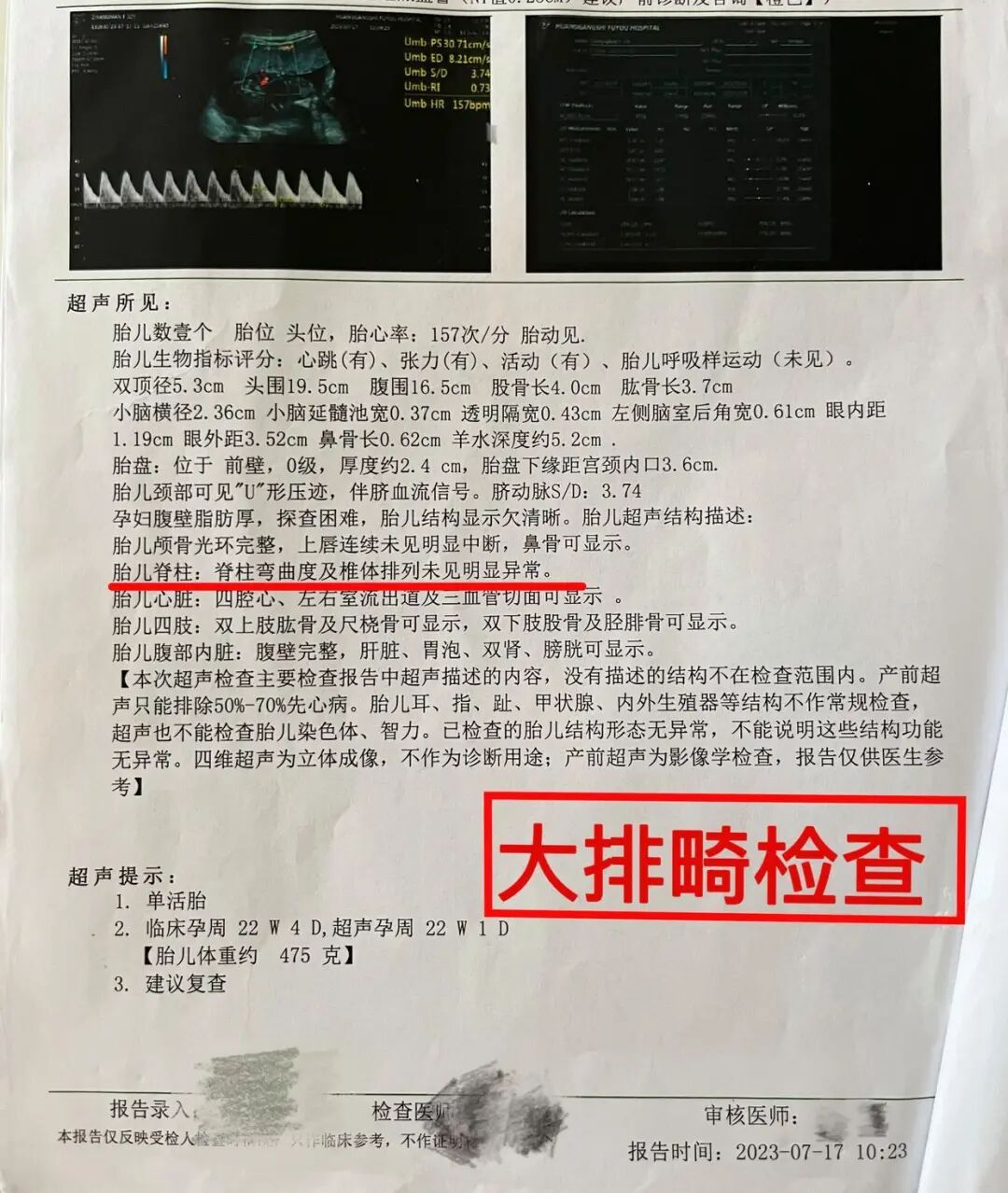 “产检一切正常，小孩出生却得了先天性脊柱畸形”，官方通报