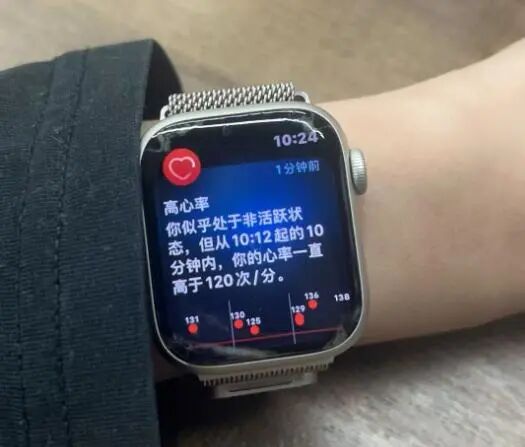 有一种焦虑叫“手表说我没睡好”