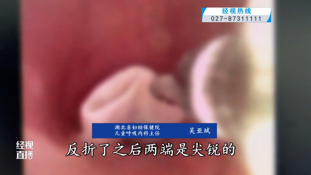 8岁男孩咬吸管打闹，一阵大笑吸管“窜”进气管！医生紧急提醒