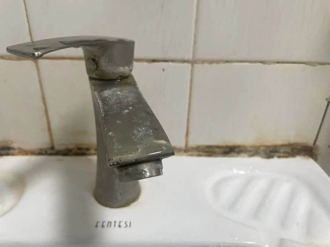 6岁女童发烧17天，脑子被啃出十几个洞，家里这种情况要注意！