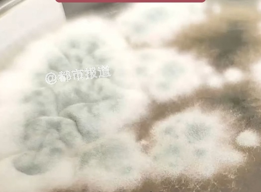 再晚几天，脑子就全被“啃空”！6岁女孩连续发烧17天，医生检查后惊了