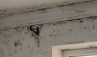 6岁女童发烧17天，脑子竟被“啃”出十几个洞，医生紧急提醒：小心霉菌“爬”进脑子