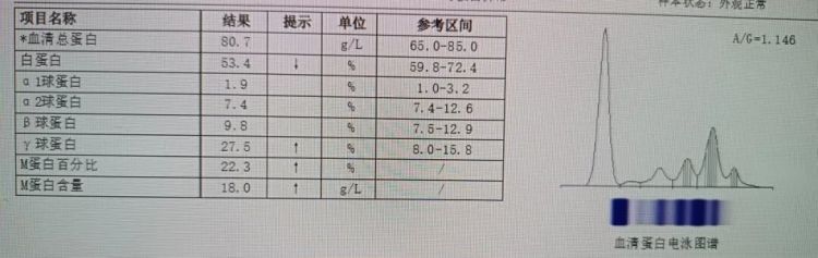 扫个灰锁骨“断”了？竟是因为肿瘤！一年前就有“警告”