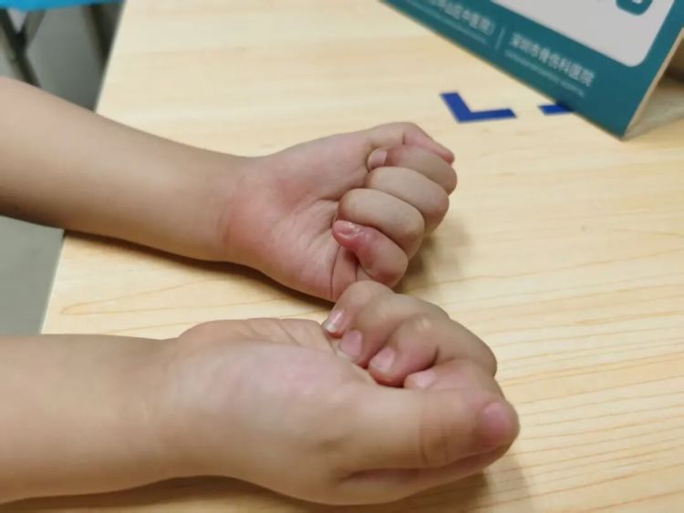 3岁女童手指突然被夹断！“凶器”每家都有，不要不当回事