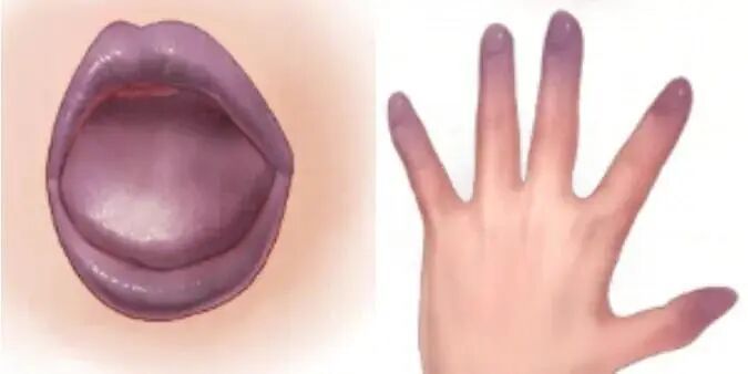 以为能吃，其实可能“有毒”的7种食物！提醒爸妈一定要扔