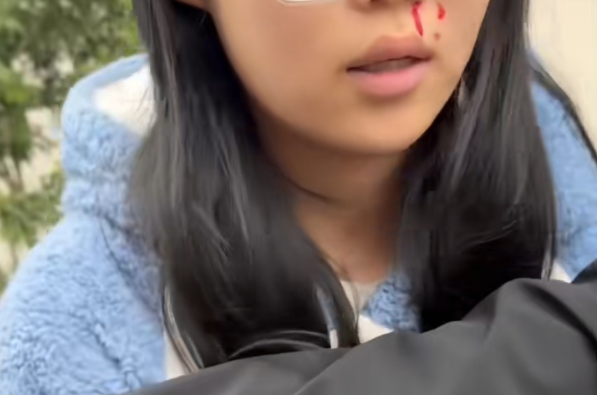 网传女子牵绳遛狗被围殴，邻居声援也被打？上海警方：已立案