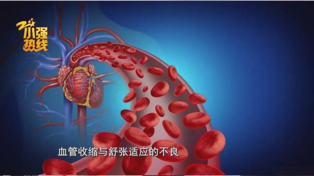 65岁男子一觉醒来身体无法动弹!医生提醒:低温天是高发期 65岁男子一觉醒来身体无法动弹!医生提醒:低温天是高发期