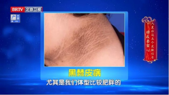 脖子黑黑的、总是洗不干净？可能是身体在“求救”！