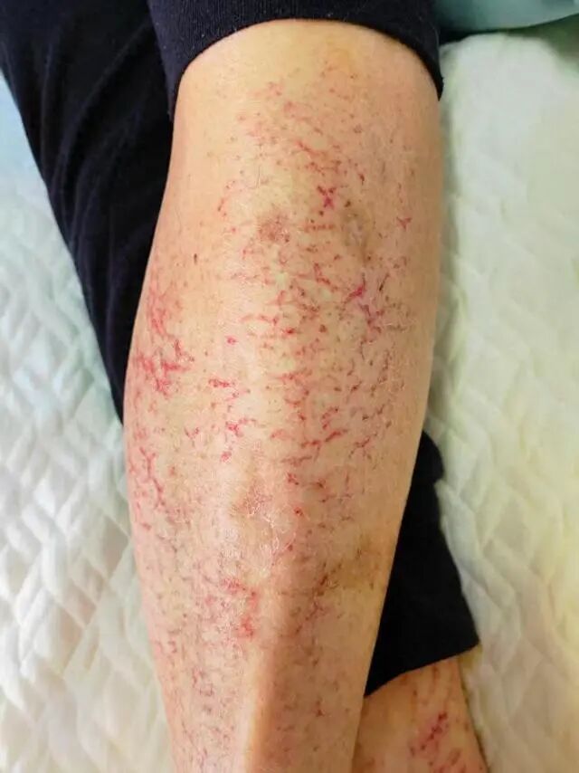 天气寒冷，使用这类取暖神器须小心