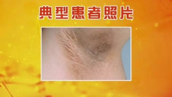 脖子黑黑的、总是洗不干净？可能是身体在“求救”！