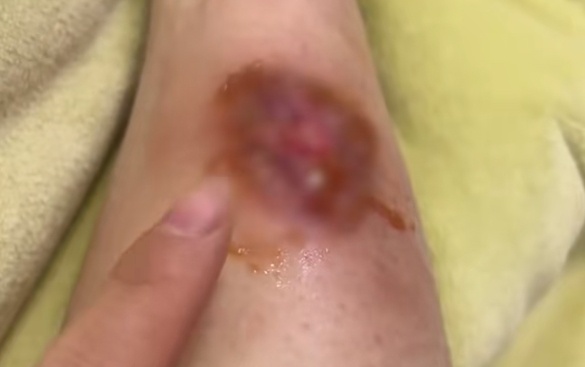 天气寒冷，使用这类取暖神器须小心