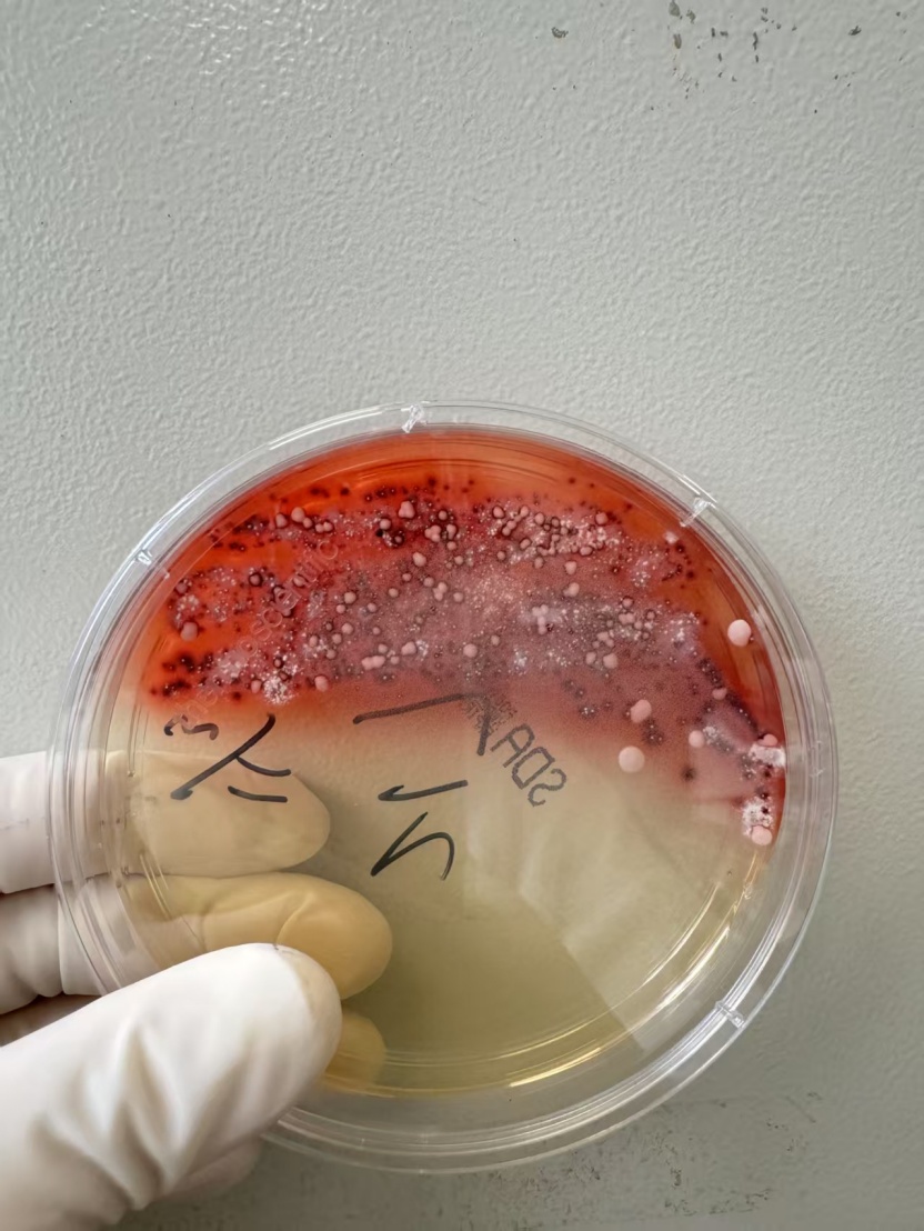 紧急提醒！这种Ⅰ类致癌物，几乎家家都有！