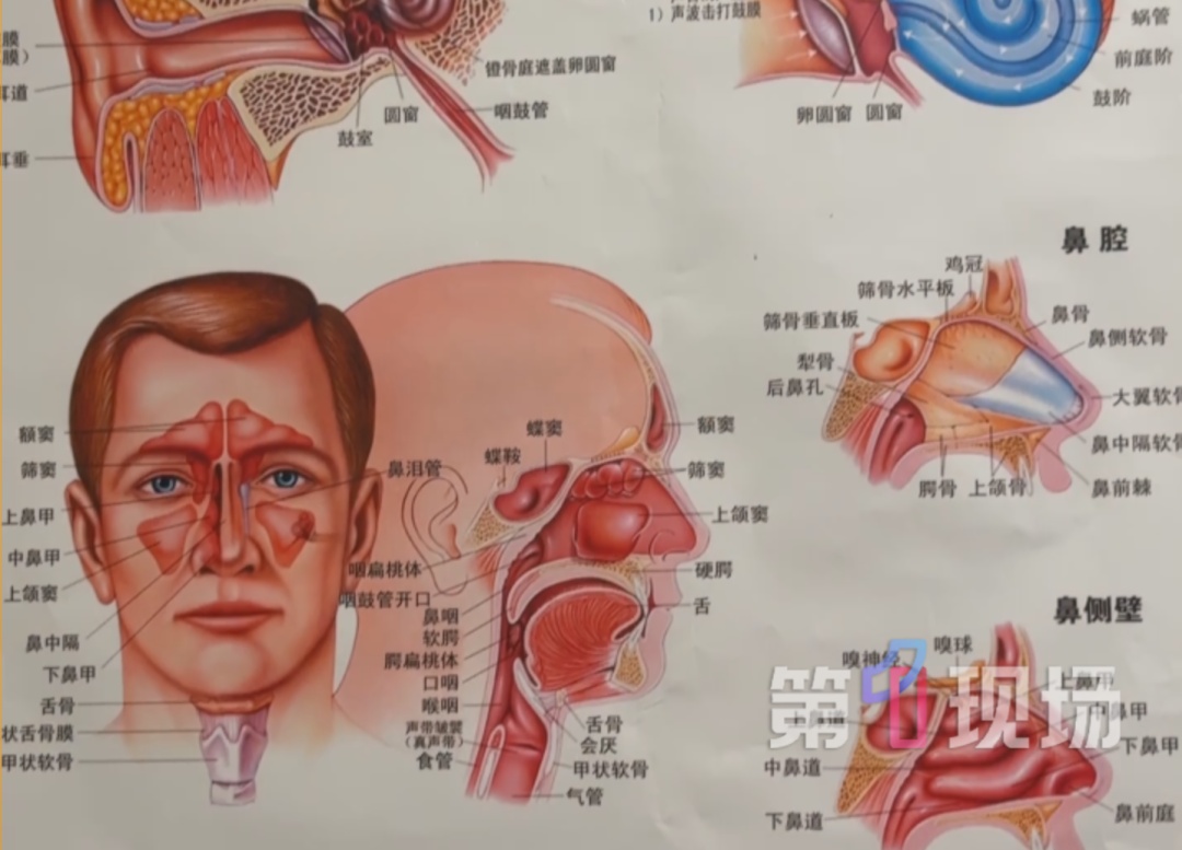 女子感冒喉咙疼了3天，差点引发窒息！医生提醒→