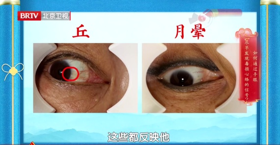 手掌出现这种褶皱，要关注自己的心脏