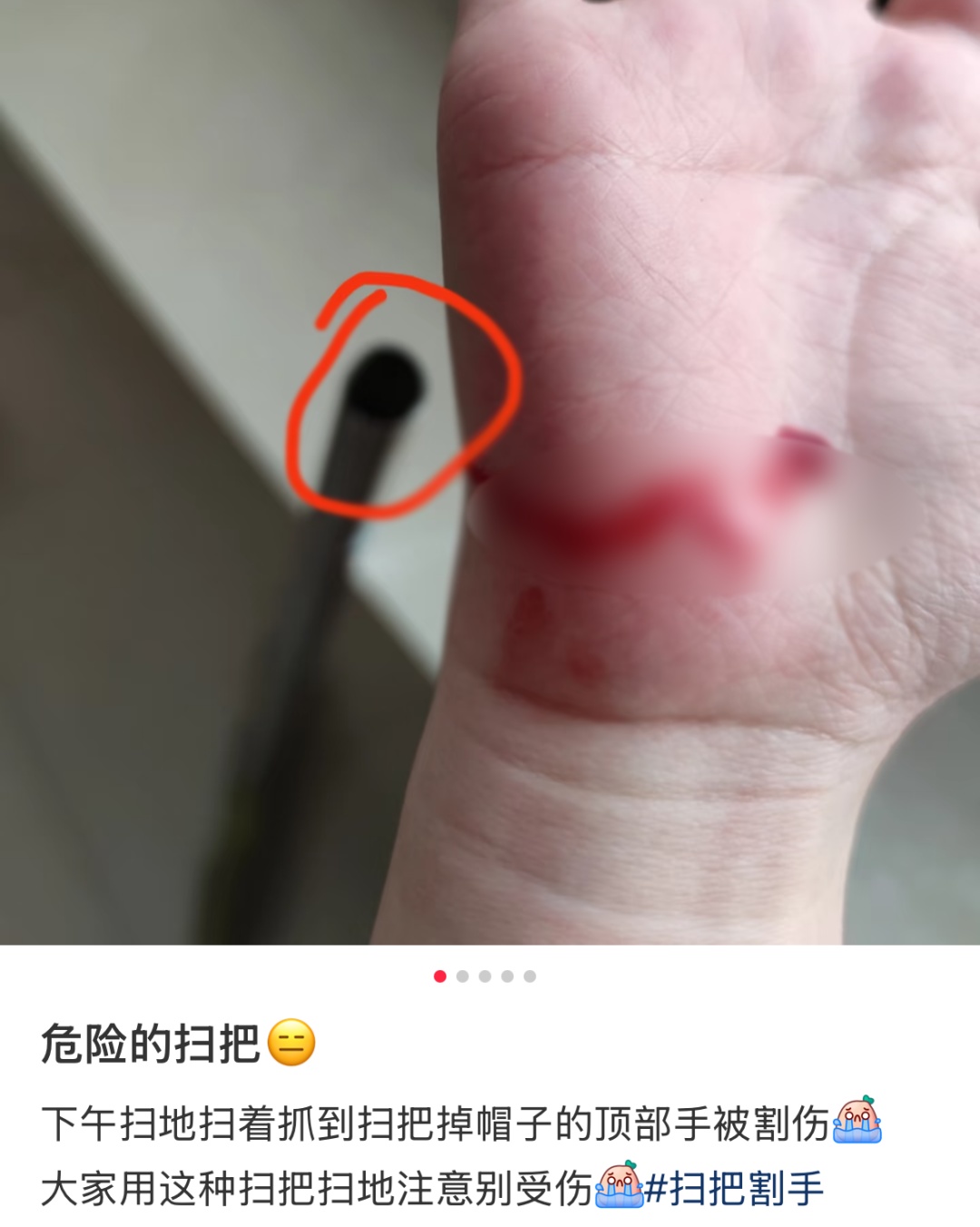 卡手还割肉 家里这种扫把使用时要注意