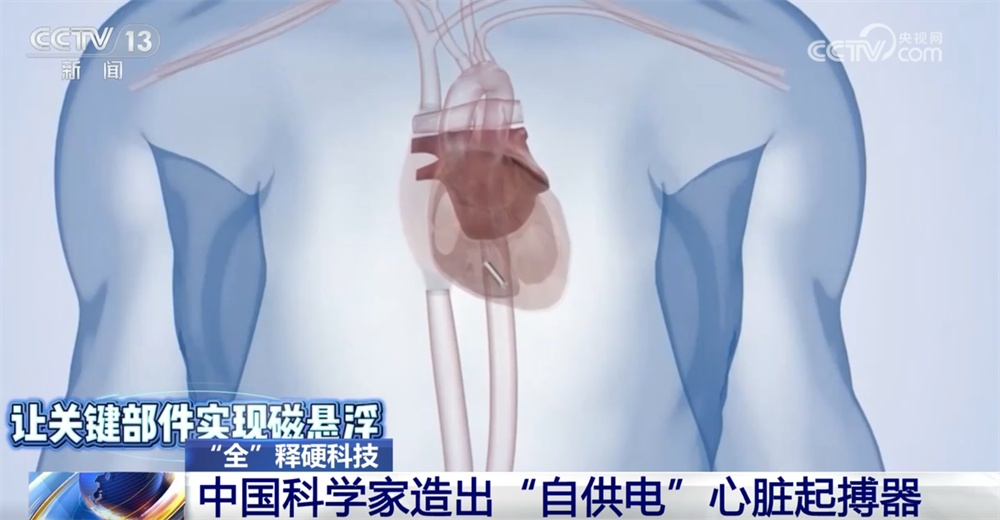当机器和人体实现“双向奔赴” 中国科学家造出“自供电”心脏起搏器