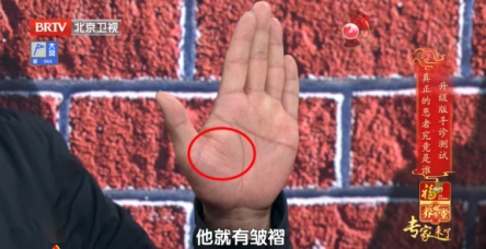 手掌出现这种褶皱，要关注自己的心脏