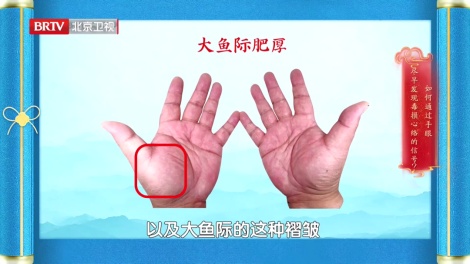 手掌出现这种褶皱，要关注自己的心脏