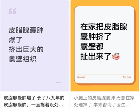 网友分享“像挤痘痘一样暴力挤皮脂腺囊肿”经验,医生:易化脓破溃!除了复发还会留疤 网友分享“像挤痘痘一样暴力挤皮脂腺囊肿”经验,医生:易化脓破溃!除了复发还会留疤