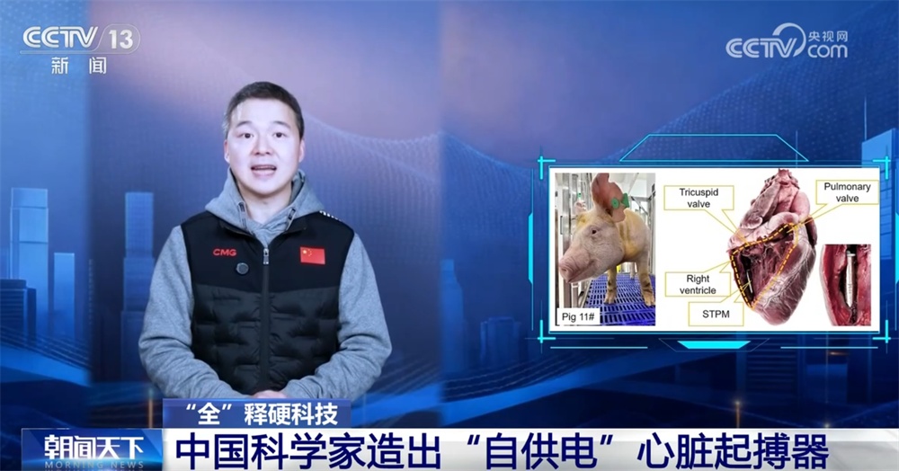 当机器和人体实现“双向奔赴” 中国科学家造出“自供电”心脏起搏器