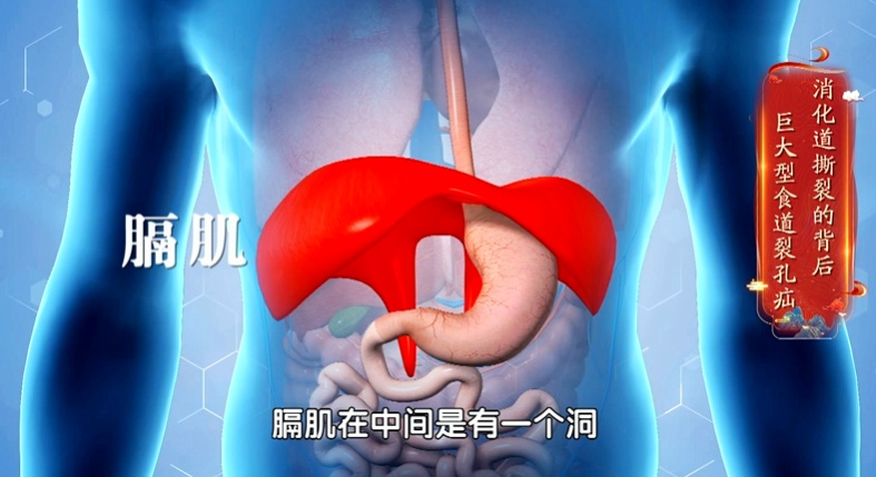 反酸、烧心,当心是这个睡姿“躺”出来的!等到胃“消失”就晚了…… 反酸、烧心,当心是这个睡姿“躺”出来的!等到胃“消失”就晚了……