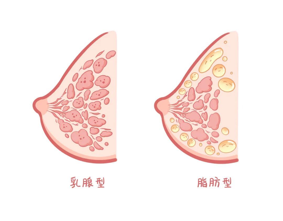 乳腺报告“异常”别焦虑！这可能是身体在和你“撒娇”