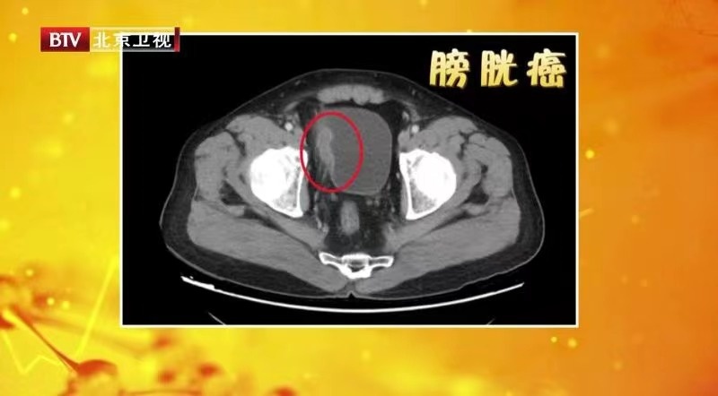 睡觉出现这5种表现，千万要警惕了