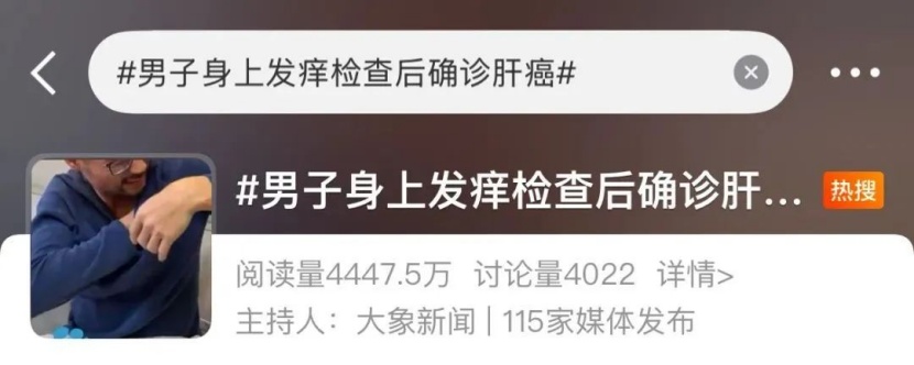 从身上痒到癌症晚期,仅90天!这几种瘙痒别当成小事 从身上痒到癌症晚期,仅90天!这几种瘙痒别当成小事