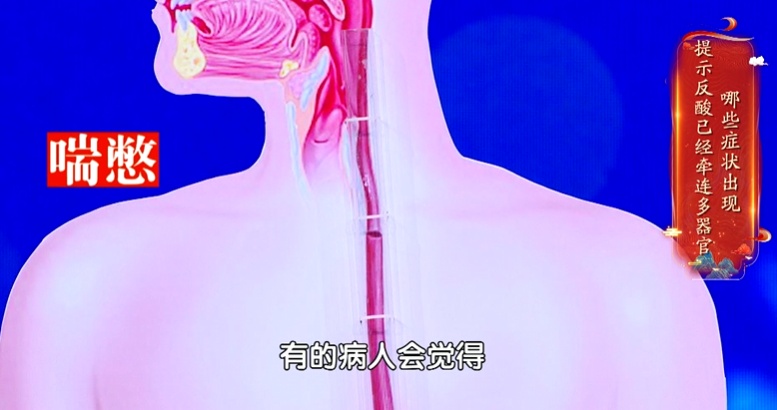 反酸、烧心,当心是这个睡姿“躺”出来的!等到胃“消失”就晚了…… 反酸、烧心,当心是这个睡姿“躺”出来的!等到胃“消失”就晚了……