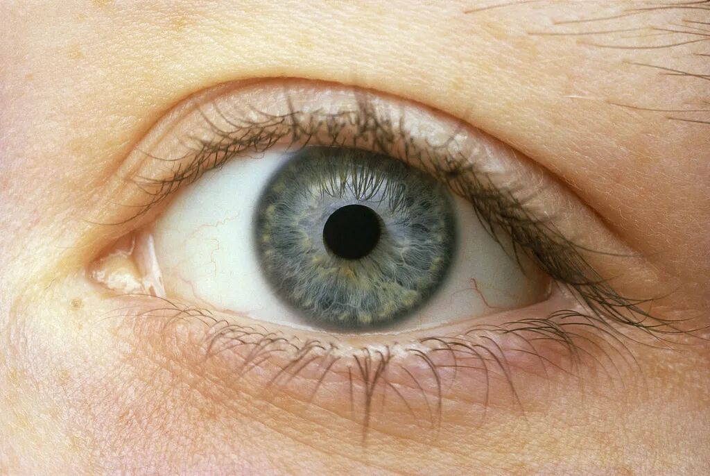 有人差点毁容！有人右眼失明！当心这口家家常用的锅…