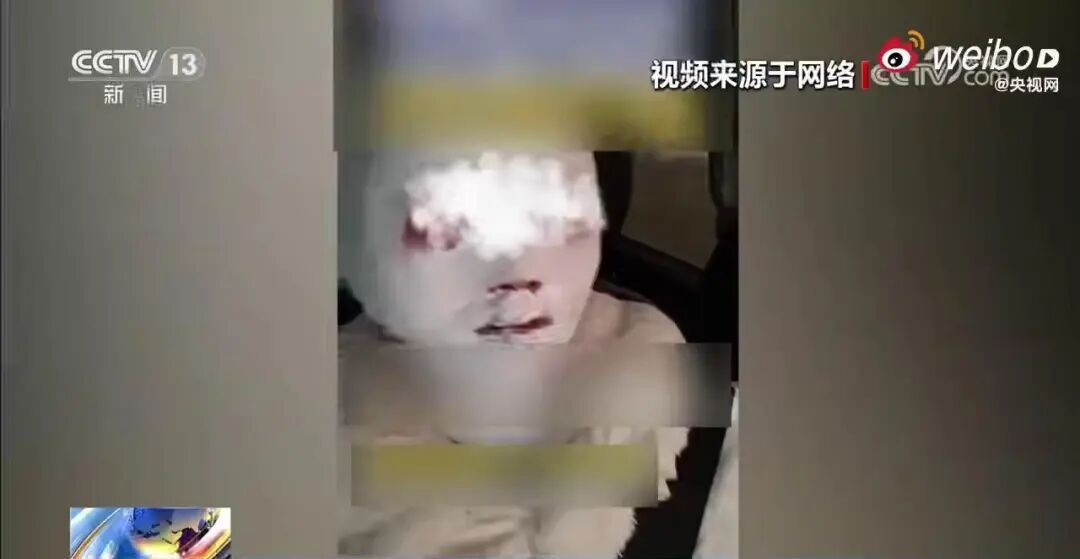 有人差点毁容！有人右眼失明！当心这口家家常用的锅…