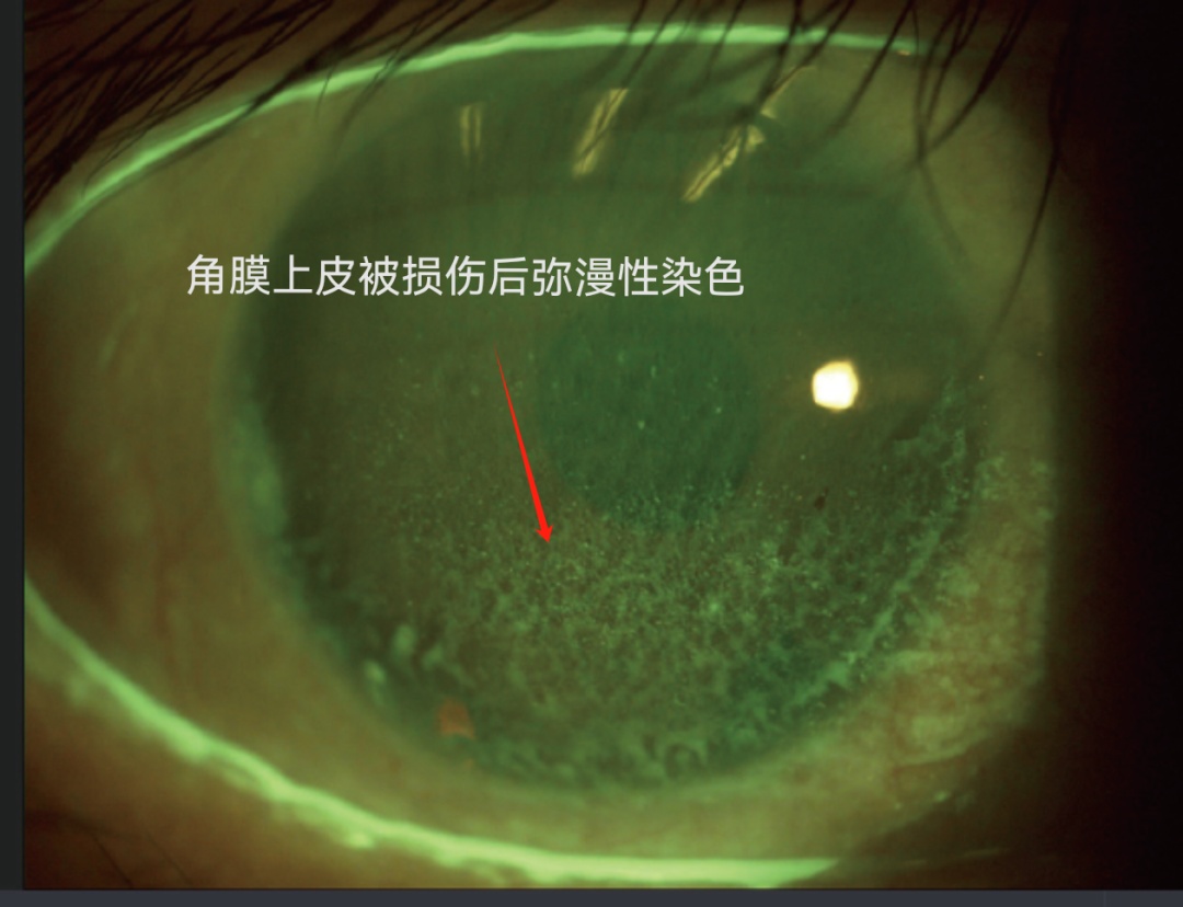 一种巨伤眼的行为，很多女生最近都在做！（不是戴美瞳）