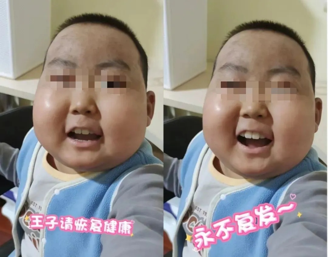 痛惜！抗癌“小王子”豪豪离世，年仅10岁