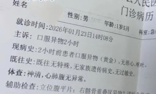 1岁多宝宝把金锁嚼碎吞了 拍片后无大碍 妈妈笑称生了个“吞金兽”