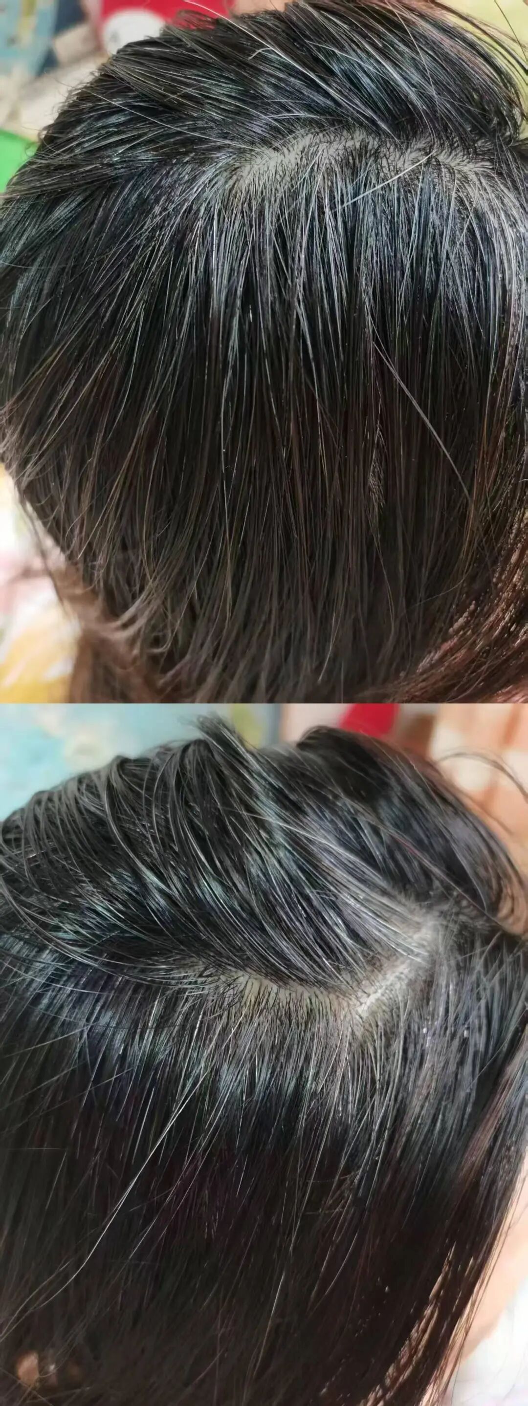 白头发“一洗就能黑”?揭开“黑科技洗发水”的真面目 白头发“一洗就能黑”?揭开“黑科技洗发水”的真面目