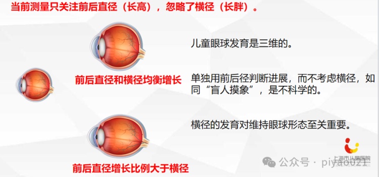 眼轴变长，近视就一定加深？上海市儿童医院眼科主任答疑
