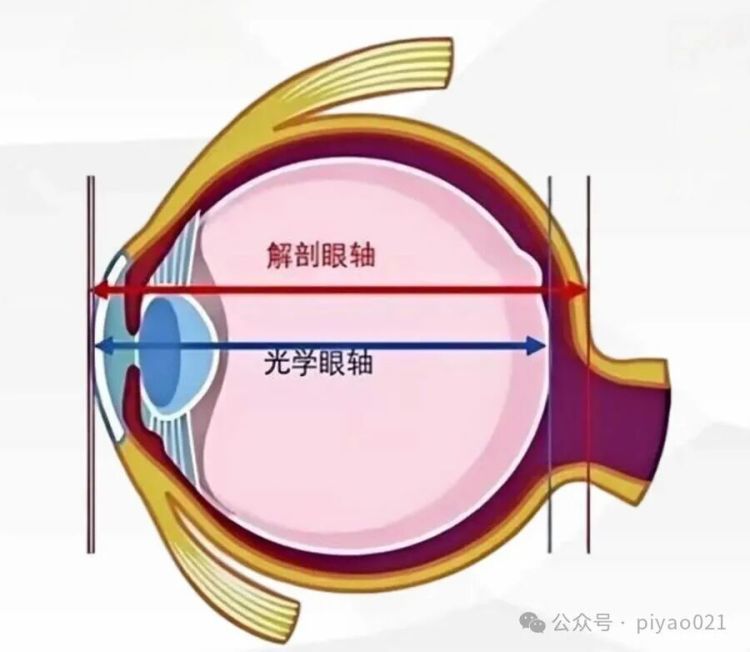 眼轴变长，近视就一定加深？上海市儿童医院眼科主任答疑