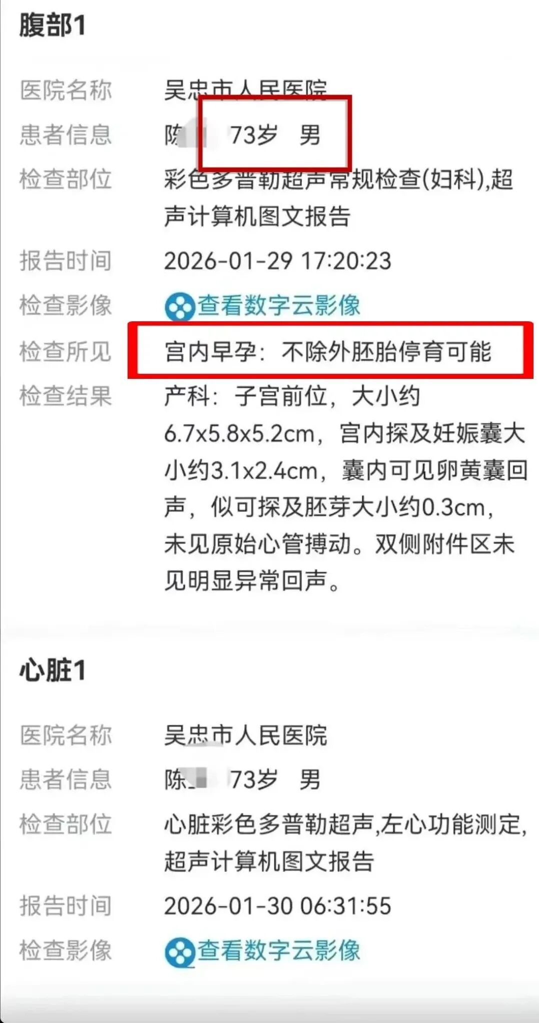 73岁男子检查结果显示“宫内早孕,不排除胚胎停育可能”,涉事医院致歉→ 73岁男子检查结果显示“宫内早孕,不排除胚胎停育可能”,涉事医院致歉→