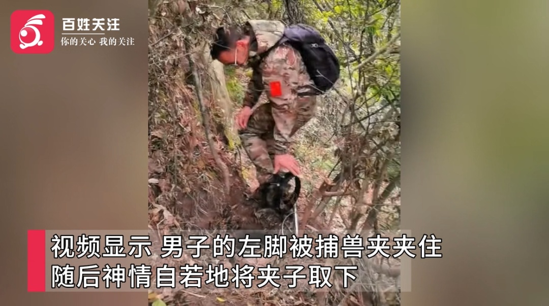 看着都疼!湖北一驴友徒步“不走寻常路”,在一条“有挑战性”的山路误踩捕兽夹 看着都疼!湖北一驴友徒步“不走寻常路”,在一条“有挑战性”的山路误踩捕兽夹