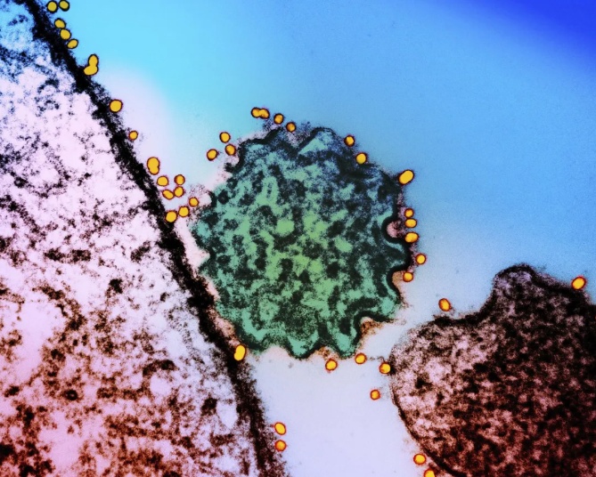 “致命尼帕”会全球流行吗？该如何防护？